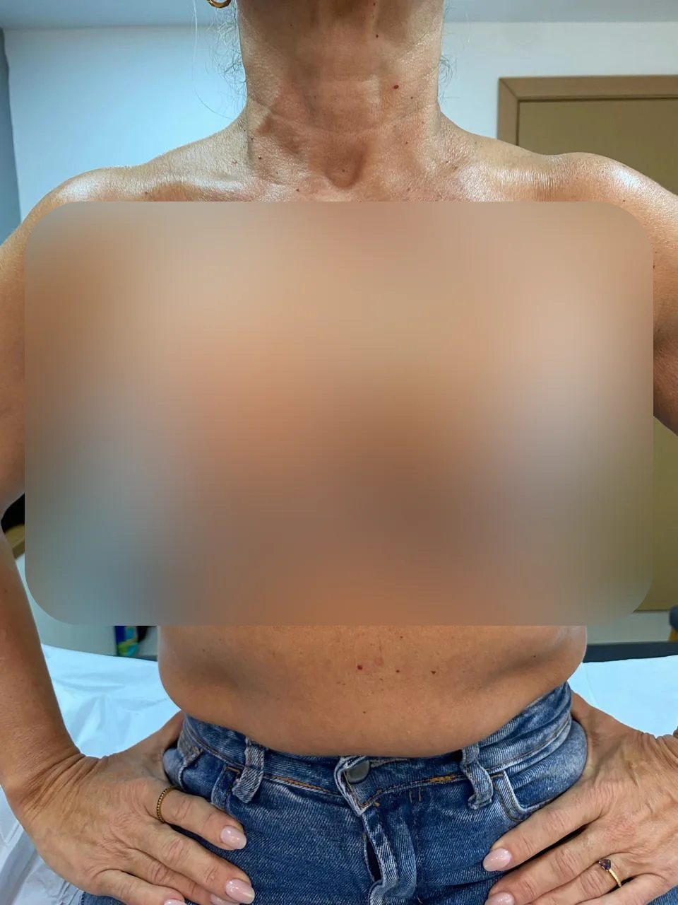 Cuidados com ferida no pós-operatório com área sensível desfocada.